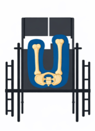 Actual structural LLD